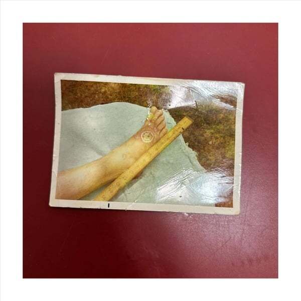 Cover art for Anthocyanins / Side Effects May Include